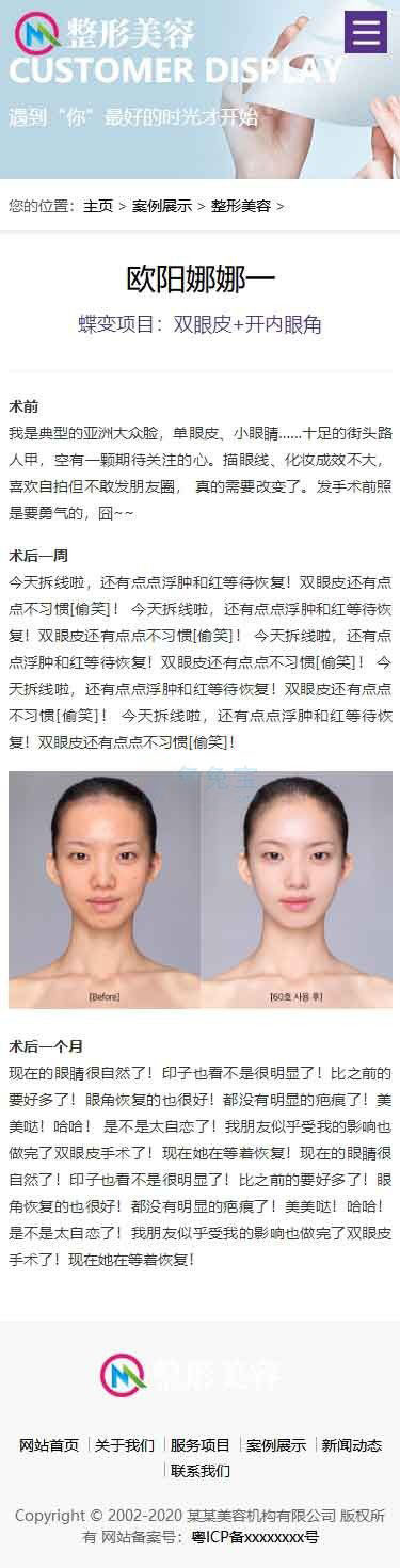 手机端案例内容页